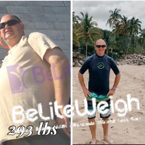 Gary B - 1 Year Update*